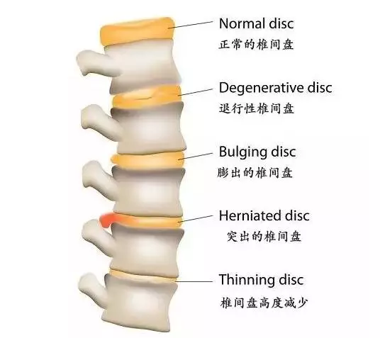 瑜伽瘦腿长高，现在开始练还不迟