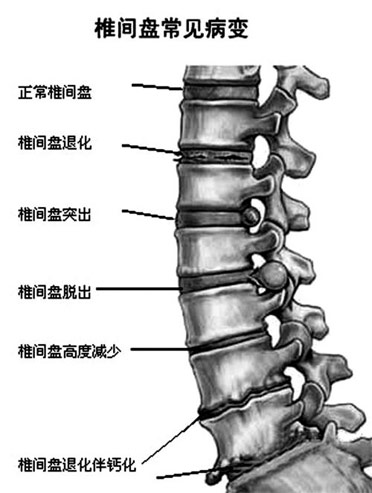 练习瑜伽腰疼，瑜伽老师该怎么应对？