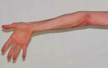 你练习瑜伽是不是有超伸？