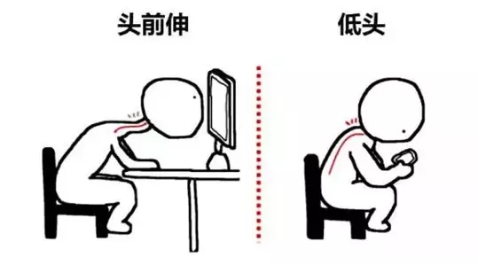 颈椎病怎么用理疗瑜伽改善?