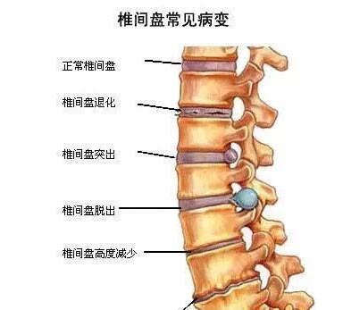 脊椎的准确位置图片图片